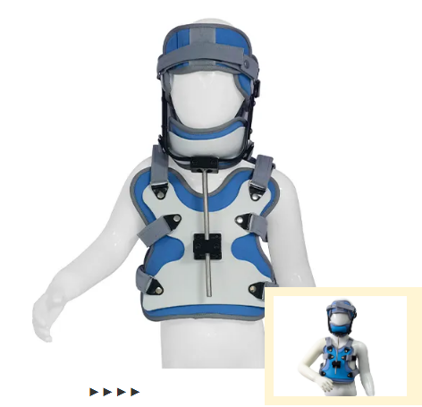 儿童斜颈的治疗的