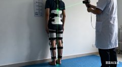 脊柱侧弯手术的术后康复：分阶段科学管