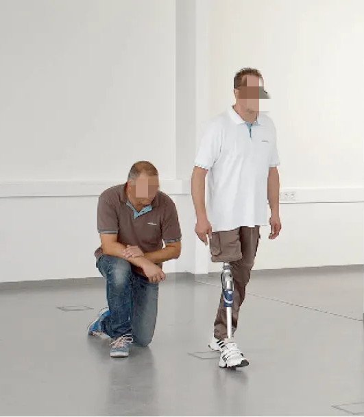 假肢---重新学习走路