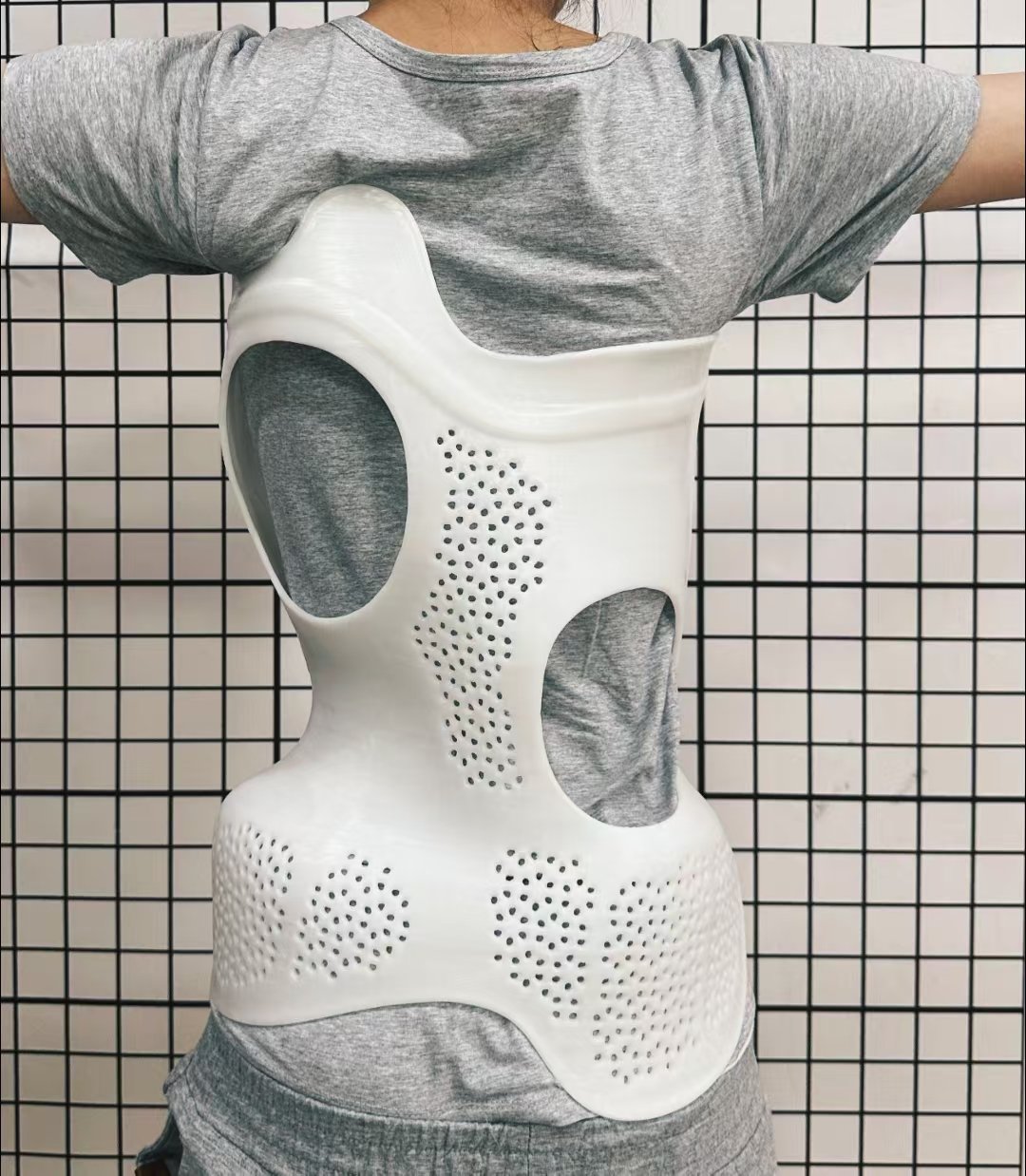 脊柱侧弯矫正器的作用