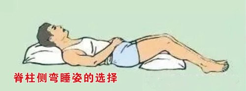 睡姿不正确会对脊柱侧弯产生影响吗?