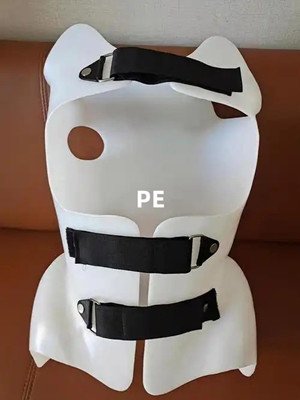 脊柱侧弯支具材料的使用