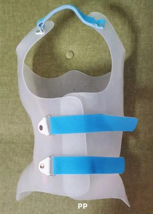 脊柱侧弯支具材料的使用